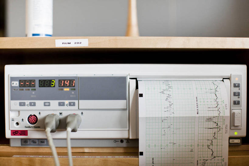 无人,医院,横图,室内,特写,白天,正面,机器,零件,电路,静物,关闭,阴影,反射,科学,医学,英文,标志,文字,线条,心电图,影子,字符,字母,设备,标识,开关,按钮,打开,英文字母,医疗,医疗设备,科学技术,开启,医疗器械,医疗工具,波动,医疗机构,闭合,检测工具,彩图,病院,诊所,脉搏波,心电图机