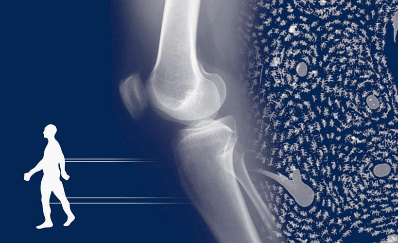 西方人,骨骼,一个人,无人,走,横图,插画,x光片,室内,白天,侧面,数码,科技,叶子,欧洲,欧洲人,仅一个男性,仅一个人,阴影,蓝色背景,辐射,科学,网络,医学,绿叶,骨头,高光,几何,计算机图形,合成,图画,画,仅一个年轻男性,嫩叶,电脑合成图,数码合成图,骨架,毒品,大麻,医疗,科学技术,x射线,合成图,x光,漫画,写实,具体,具象,大麻草,男人,男性,年轻男性,白种人,叶,叶片,步行,散步,走路,彩图,全身,电磁波,电磁辐射