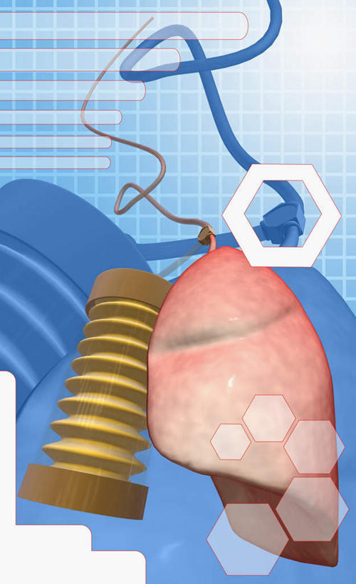 内脏,肾脏,动脉,静脉,无人,竖图,插画,室内,白天,正面,数码,科技,静物,阴影,蓝色背景,网络,医学,高光,几何,计算机图形,合成,图画,画,模型,人体,电脑合成图,数码合成图,生物学,人体器官,器官,合成图,漫画,生理学,写实,具体,具象,彩图