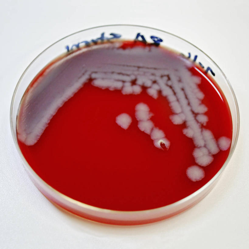 无人,方图,特写,科学,细菌,红色,生病,摄影,影棚,摄影棚,皮氏培养皿,炭疽,彩图,影棚拍摄,拍摄