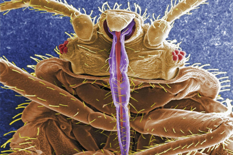 无人,横图,科学,生病,摄影,生物学,害虫,臭虫,彩图,电子显微镜