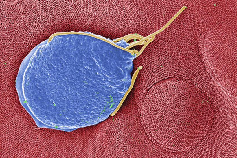 无人,横图,微生物,科学,医学,细胞,无脊椎动物,动物,生病,摄影,生物学,鞭毛,寄生虫,贾第虫,贾第虫病,微绒毛,上皮细胞,原生动物,彩图,基本组织,细胞间质,电子显微镜,上皮组织,蓝伯贾第虫,蓝氏贾第鞭毛虫,蓝氏贾第虫