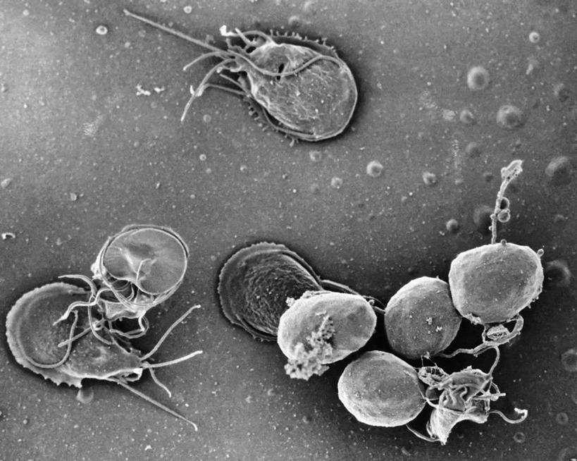 无人,横图,黑白,科学,无脊椎动物,动物,生病,摄影,寄生虫,贾第虫,贾第虫病,原生动物,囊肿,电子显微镜,蓝伯贾第虫,蓝氏贾第鞭毛虫,蓝氏贾第虫