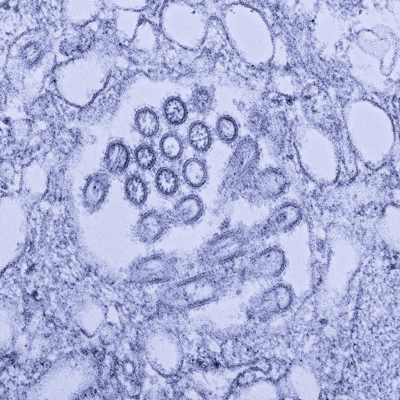 无人,方图,微生物,科学,医学,生病,生物,摄影,医疗,病毒,生物学,寄生,甲型流感病毒,禽流感病毒,生命体,生物病毒,流感病毒,彩图,电子显微镜