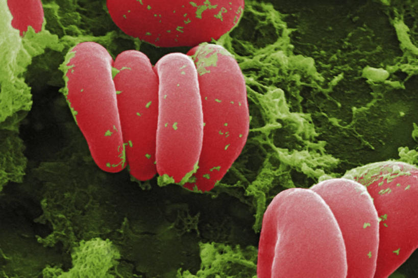 无人,横图,科学,红色,绿色,血液,摄影,红细胞,纤维蛋白,彩图,电子显微镜