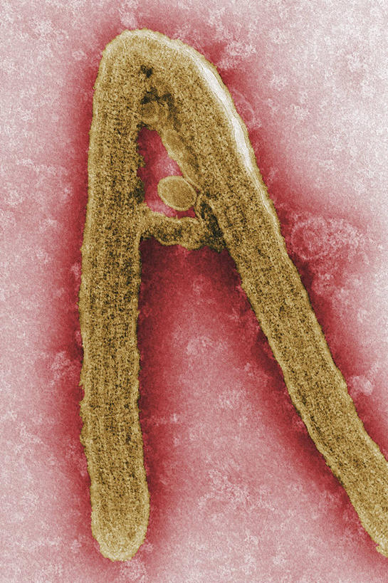 无人,竖图,科学,生病,摄影,病毒,出血热,彩图,电子显微镜,马尔堡病毒