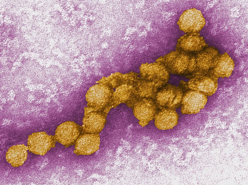 无人,横图,科学,黄色,紫色,生病,摄影,病毒,彩图,西尼罗河病毒,电子显微镜