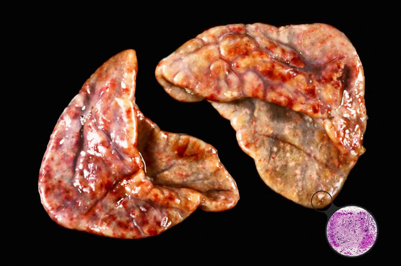 无人,横图,特写,科学,细胞,纸巾,生病,血液,摄影,放大,病毒,解剖,肿瘤,肾上腺,疱疹,微生物学,彩图,影棚拍摄,剖解