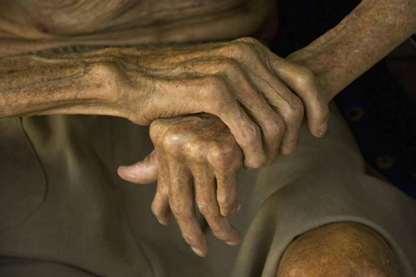 成年人,手,一个人,护士,横图,越南,仅一个男性,生病,摄影,部分,胡志明市,麻风病,男人,彩图