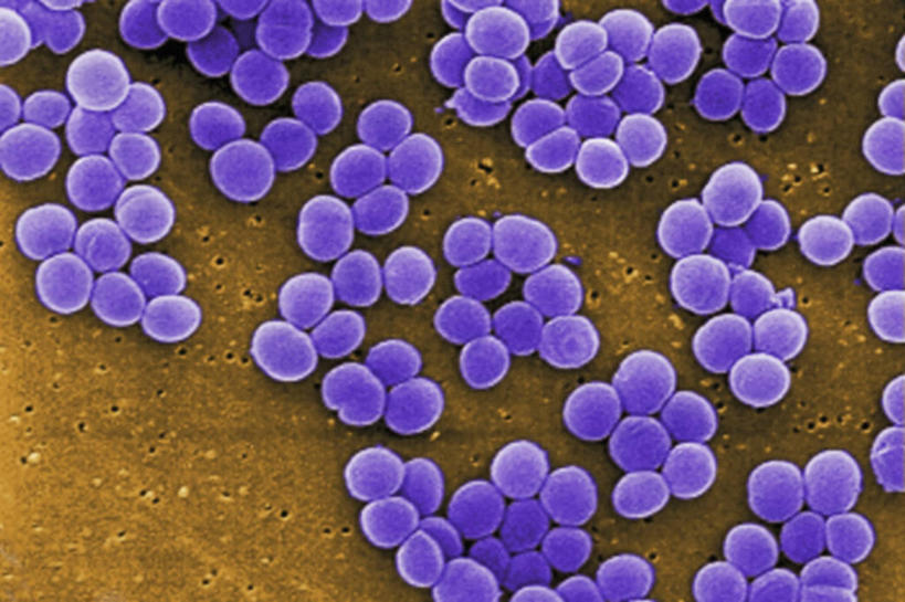 无人,横图,美国,科学,细菌,褐色,紫色,生病,摄影,金黄色葡萄球菌,彩图,电子显微镜