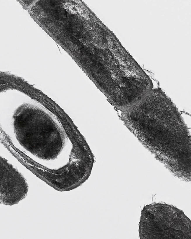 无人,竖图,黑白,科学,细胞,生病,摄影,有丝分裂,炭疽,电子显微镜