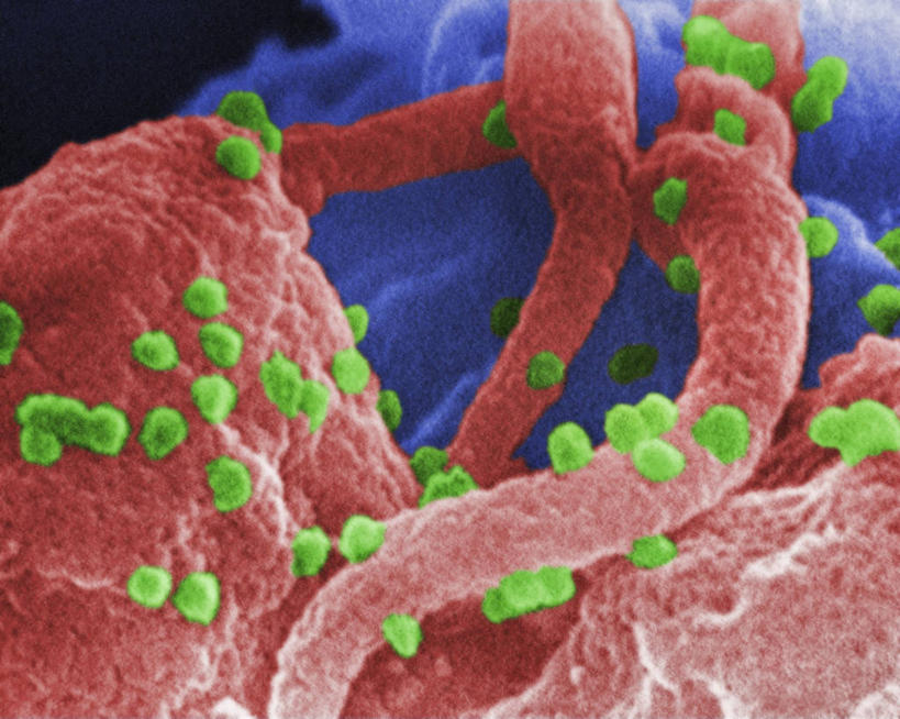无人,横图,仪器,指示牌,微生物,检查,反射,分析,科学,细菌,医学,标志,文字,显微镜,标识,观察,生病,血液,生物,清晰,探索,摄影,放大,观看,仔细,透镜,医疗,有毒物质,病毒,生物学,凸透镜,聚焦,关注,艾滋病,白细胞,光学,清楚,寄生,生命体,生物病毒,艾滋病病毒,彩图,扫描电镜,扫描电子显微镜,反转录病毒,逆转录病毒