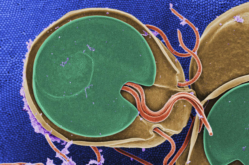 无人,横图,仪器,指示牌,微生物,检查,反射,分析,科学,细菌,医学,标志,文字,细胞,显微镜,标识,观察,生病,吸盘,清晰,探索,摄影,放大,观看,仔细,透镜,有毒物质,生物学,凸透镜,聚焦,关注,光学,清楚,鞭毛,贾第虫病,微绒毛,上皮细胞,细胞质,原生动物,彩图,扫描电镜,扫描电子显微镜,基本组织,囊肿,细胞间质,上皮组织
