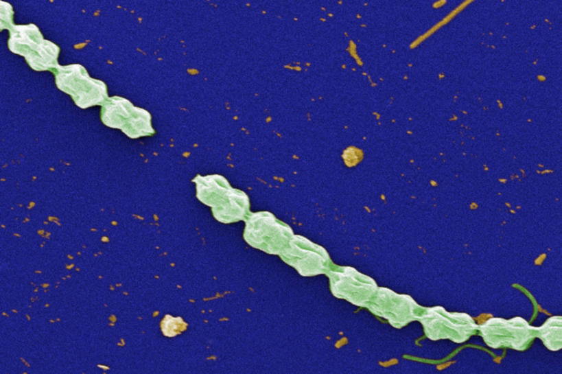 无人,横图,仪器,指示牌,微生物,检查,反射,分析,科学,细菌,标志,文字,细胞,显微镜,标识,观察,生病,清晰,探索,摄影,放大,观看,仔细,透镜,有毒物质,凸透镜,聚焦,藻类,关注,光学,清楚,绿藻,原生动物,彩图,扫描电镜,扫描电子显微镜