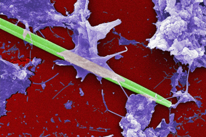 无人,横图,仪器,指示牌,微生物,检查,反射,分析,科学,细菌,标志,文字,显微镜,标识,观察,生病,清晰,探索,摄影,放大,观看,仔细,透镜,有毒物质,凸透镜,聚焦,藻类,关注,光学,清楚,绿藻,原生动物,彩图,扫描电镜,扫描电子显微镜