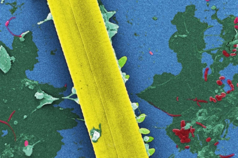 无人,横图,仪器,指示牌,微生物,检查,反射,分析,科学,细菌,标志,文字,显微镜,标识,观察,生病,清晰,探索,摄影,放大,观看,仔细,透镜,有毒物质,凸透镜,聚焦,藻类,关注,光学,清楚,绿藻,原生动物,彩图,扫描电镜,扫描电子显微镜