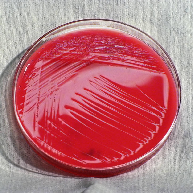 无人,方图,药,研究,细菌,红色,摄影,抗生素,皮氏培养皿,彩图,血琼脂,传统文化