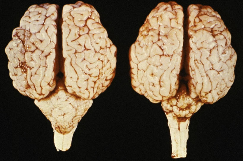脑,无人,横图,指示牌,牛,标志,文字,标识,生病,摄影,有毒物质,痛苦,小脑,彩图