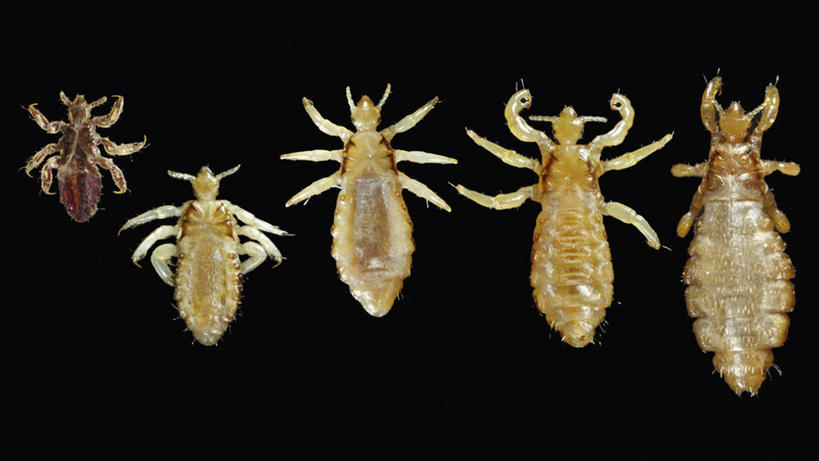 无人,横图,五个,许多,黑色背景,螃蟹,昆虫,摄影,怪异,节肢动物,虱子,体虱,彩图,阴虱,头虱