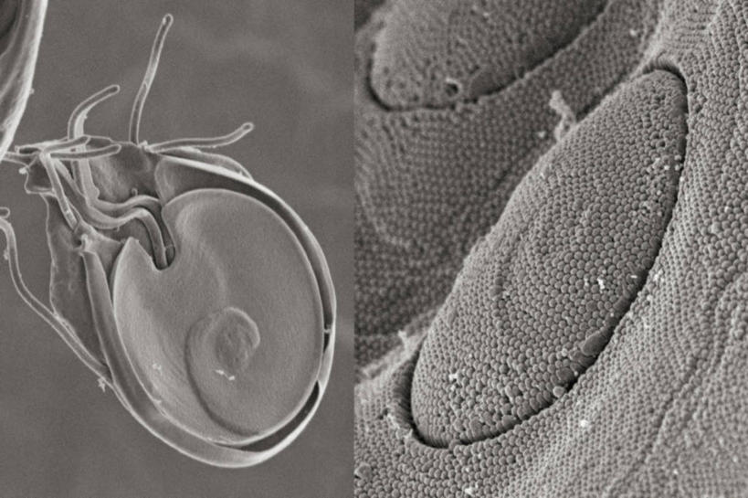 无人,横图,黑白,仪器,检查,反射,分析,科学,显微镜,无脊椎动物,动物,观察,生病,清晰,探索,摄影,放大,观看,仔细,透镜,伤口,凸透镜,聚焦,关注,光学,清楚,寄生虫,贾第虫,贾第虫病,原生动物,扫描电镜,扫描电子显微镜,蓝伯贾第虫,蓝氏贾第鞭毛虫,蓝氏贾第虫