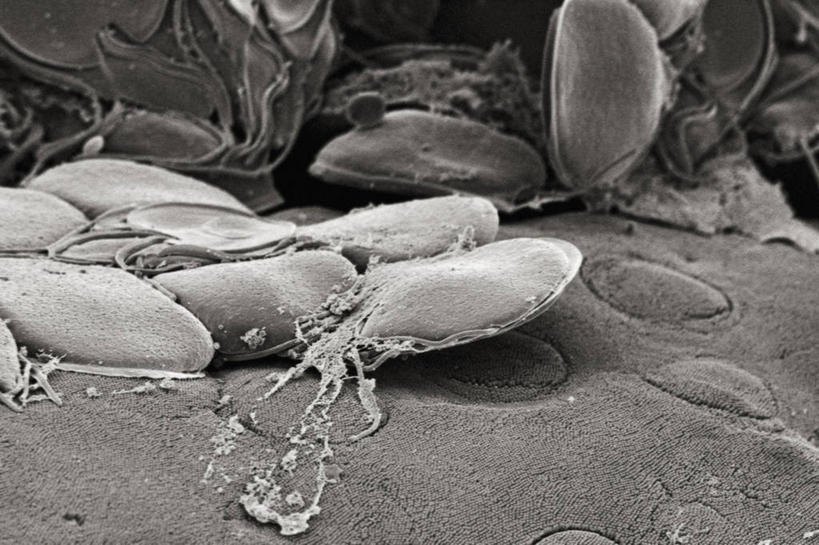 无人,横图,黑白,仪器,检查,反射,分析,科学,显微镜,无脊椎动物,动物,观察,生病,清晰,探索,摄影,放大,观看,仔细,透镜,伤口,凸透镜,聚焦,关注,光学,清楚,寄生虫,贾第虫,贾第虫病,原生动物,扫描电镜,扫描电子显微镜,蓝伯贾第虫,蓝氏贾第鞭毛虫,蓝氏贾第虫