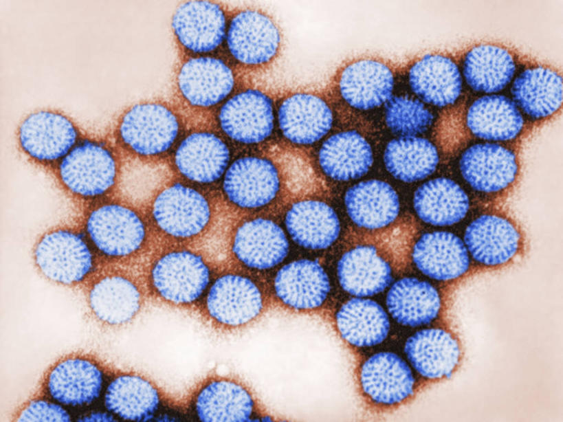 无人,横图,生病,摄影,彩图,透射电子显微镜