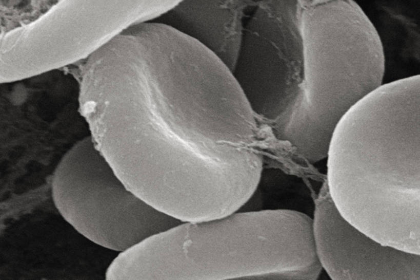 无人,横图,黑白,仪器,检查,反射,分析,科学,血,显微镜,痕迹,观察,血液,清晰,探索,摄影,放大,观看,仔细,凝结,透镜,凸透镜,聚焦,关注,血迹,光学,清楚,红细胞,扫描电镜,扫描电子显微镜