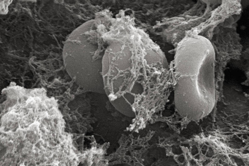 无人,横图,黑白,仪器,检查,反射,分析,科学,血,显微镜,痕迹,观察,血液,清晰,探索,摄影,放大,观看,仔细,凝结,透镜,凸透镜,聚焦,关注,血迹,光学,清楚,红细胞,扫描电镜,扫描电子显微镜