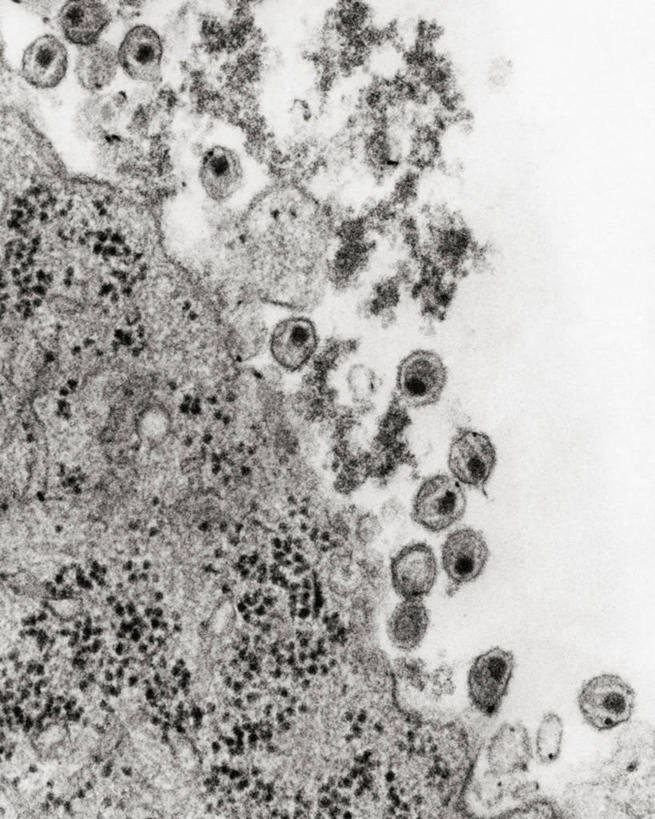 无人,竖图,黑白,微生物,医学,生病,血液,生物,摄影,医疗,病毒,生物学,艾滋病,白细胞,寄生,生命体,生物病毒,艾滋病病毒,透射电子显微镜,反转录病毒,逆转录病毒