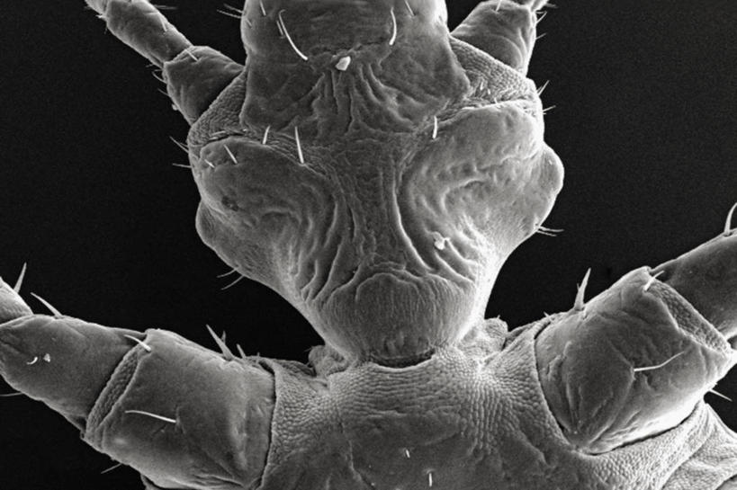 无人,横图,黑白,仪器,检查,反射,分析,科学,昆虫,显微镜,盘子,观察,清晰,探索,摄影,放大,观看,保护,仔细,透镜,胸腔,凸透镜,聚焦,关注,节肢动物,虱子,光学,清楚,跗骨,胫骨,体虱,扫描电镜,扫描电子显微镜