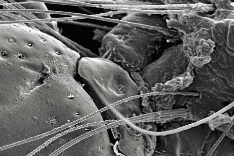 无人,横图,黑白,昆虫,摄影,节肢动物,莱姆病,野兔病,立克次氏体,口下板