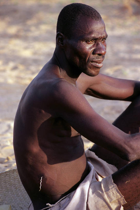 成年人,中年人,一个人,竖图,室外,白天,非洲,尼日尔,尼日利亚,仅一个男性,仅一个人,仅一个中年男性,裸露,生病,摄影,裸,惊骇,男人,男性,中年男性,非洲人,彩图,游牧民族