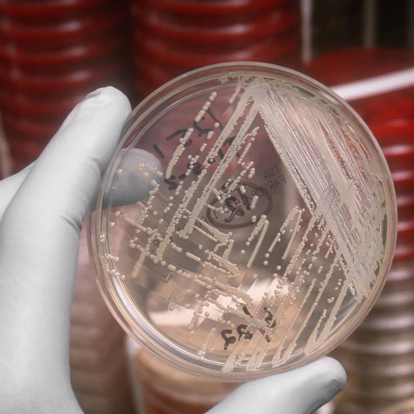 一个人,方图,室内,安全,检查,研究,科学,细菌,圆形,实验室,防护,拿着,手套,生病,生物,摄影,保护,生物学,抗生素,保险,监视,皮氏培养皿,科学实验,保全,周全,安稳,安定,防护手套,金黄色葡萄球菌,解决,平安,技术员,彩图