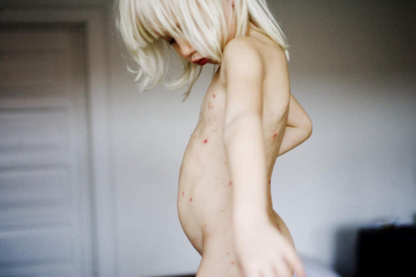 西方人,儿童,头发,一个人,横图,室内,白天,侧面,微生物,欧洲,欧洲人,仅一个女性,仅一个人,阴影,光线,医学,影子,斑点,注视,裸露,小孩,低头,观察,看,仅一个小孩,生病,金色,生物,赤裸,观看,察看,医疗,病毒,生物学,关注,裸,寄生,生命体,生物病毒,抱病,密密层层,密密麻麻,女孩,女人,女性,白种人,孩子,半身,彩图,女生