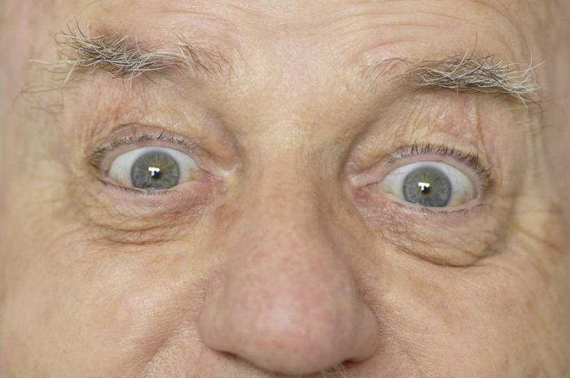 西方人,脸,头,眼睛,脸颊,眉毛,睫毛,一个人,横图,室内,特写,白天,白色背景,正面,欧洲,欧洲人,瞳孔,仅一个男性,仅一个人,阴影,光线,影子,灯光,仅一个老年男性,眼部,摄影,影棚,瞪眼,苍老,衰老,朽迈,老年男性,男人,男性,白种人,头部,睫,脸部,脸蛋,眉,面部,眼,眼睫毛,眼眉,半身,彩图,影棚拍摄,拍摄,眼眉毛