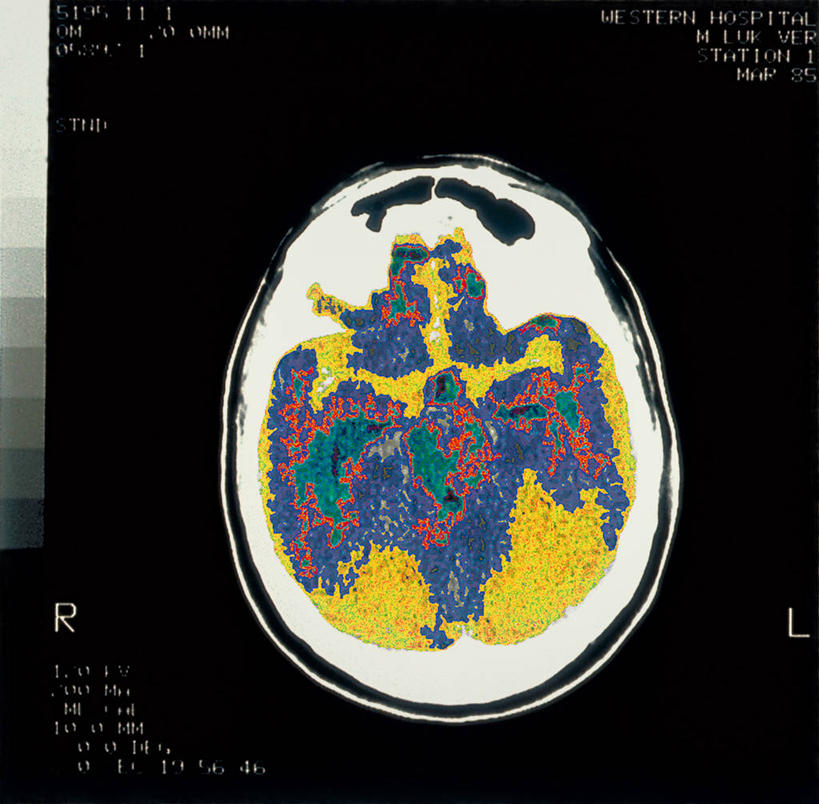 内脏,动脉,静脉,骨骼,无人,横图,室内,白天,正面,静物,黑色背景,医学,人头骨,骨头,模型,人体,骨架,生物学,人体器官,器官,生理学,彩图