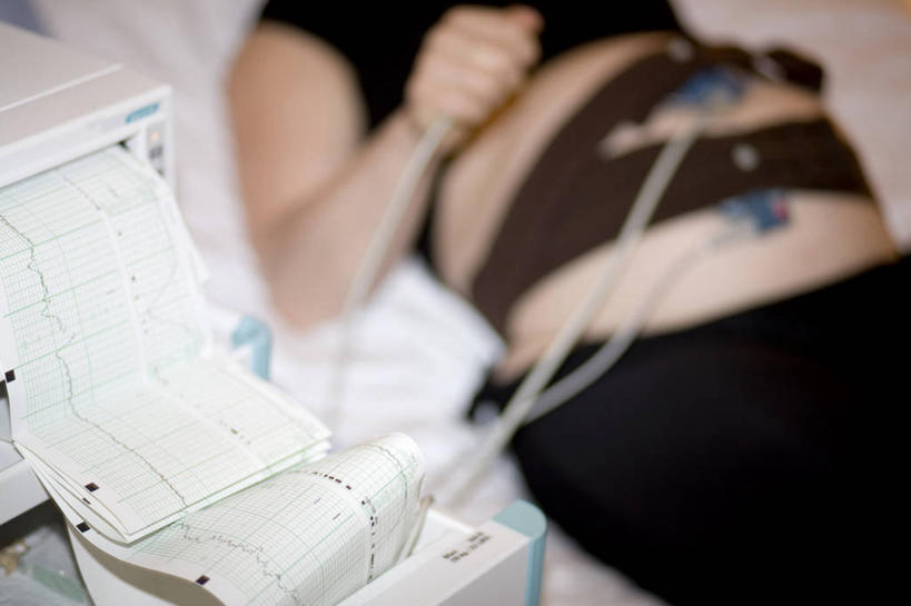 西方人,孕妇,一个人,医院,躺,横图,俯视,室内,白天,仪器,床,欧洲,欧洲人,仅一个年轻女性,仅一个女性,仅一个人,一张,握,阴影,光线,影子,床单,纸张,拿,拿着,被子,白色,阳光,怀孕,握着,单人床,数据线,被单,待产,医疗器械,医疗机构,妊娠,准妈妈,卧着,仪表,年轻女性,女人,女性,白种人,产妇,躺着,卧,彩图,高角度拍摄,病院,诊所