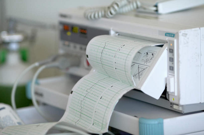 无人,医院,横图,俯视,室内,特写,白天,机器,仪器,静物,一排,朦胧,模糊,整齐,测量,排列,机械,医疗设备,队列,医疗机构,彩图,高角度拍摄,病院,诊所,打印