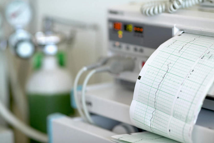 无人,医院,横图,俯视,室内,特写,白天,机器,仪器,静物,一排,朦胧,模糊,整齐,测量,排列,机械,医疗设备,队列,医疗机构,彩图,高角度拍摄,病院,诊所,打印