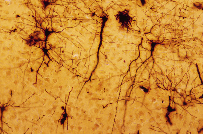 无人,横图,竖图,人体,摄影,生物学,人体结构,微生物学,彩图,全画面,全框架,全帧,锥体细胞,全画幅,神经系统,神经组织