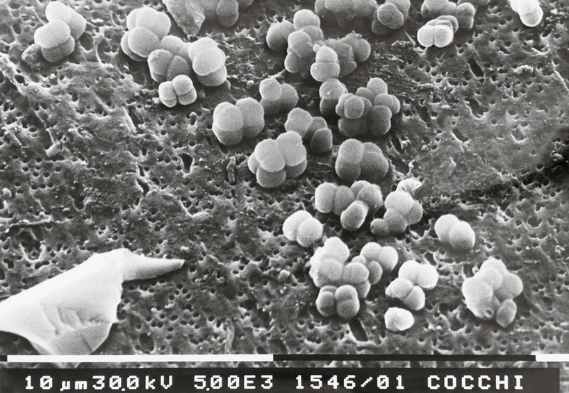 无人,横图,黑白,特写,研究,科学,细菌,数字,摄影,生物学,扫描电子显微镜