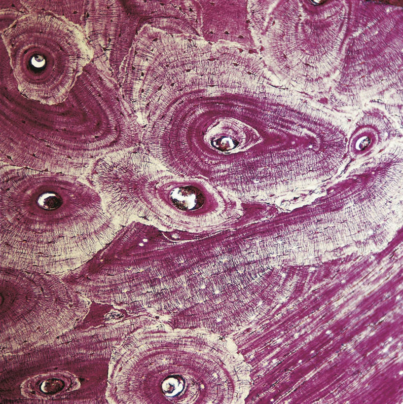 骨骼,无人,竖图,方图,纸巾,人体,摄影,腿骨,股骨,微生物学,彩图,全画面,全框架,全帧,全画幅