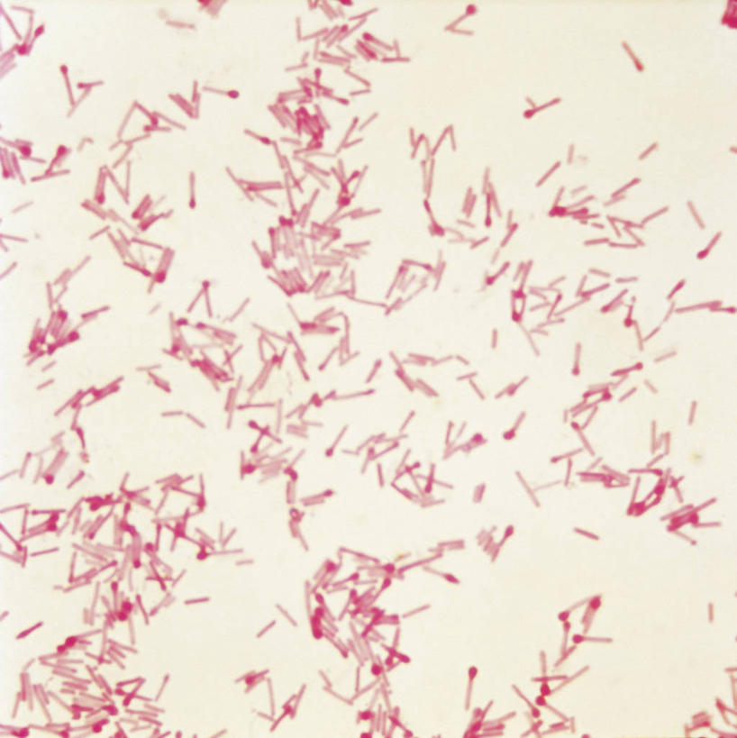 无人,竖图,方图,插画,数码,科技,阴影,网络,高光,几何,计算机图形,合成,图画,画,摄影,电脑合成图,数码合成图,生物学,合成图,漫画,写实,具体,具象,破伤风杆菌,微生物学,彩图