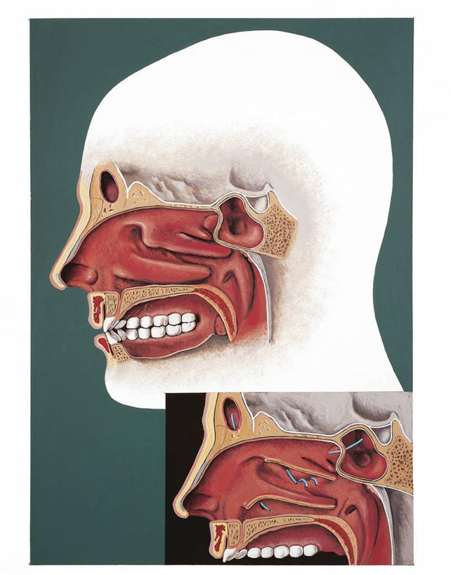 头,鼻子,无人,竖图,插画,侧面,数码,科技,阴影,科学,网络,高光,几何,计算机图形,合成,图画,画,纸巾,人体,电脑合成图,数码合成图,生物学,合成图,横截面,漫画,鼻腔,写实,具体,具象,人体结构,头部,鼻,鼻孔,彩图