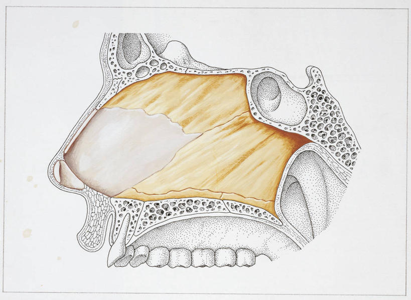 头,鼻子,骨骼,肌肉,健壮,无人,横图,插画,白色背景,数码,科技,阴影,科学,网络,骨头,高光,几何,计算机图形,合成,图画,画,白色,纸巾,健康,活力,力量,人体,青春,部分,电脑合成图,数码合成图,骨架,生物学,强壮,合成图,横截面,漫画,鼻腔,软骨,写实,具体,具象,人体结构,头部,鼻,鼻孔,彩图,鼻中隔