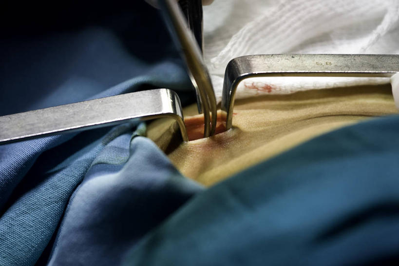 一个人,医生,医院,横图,俯视,室内,特写,阿根廷,首都,南美,摄影,手术,手术室,准确,医疗器械,外科医生,布宜诺斯艾利斯,技能,手术器械,高角度拍摄,月