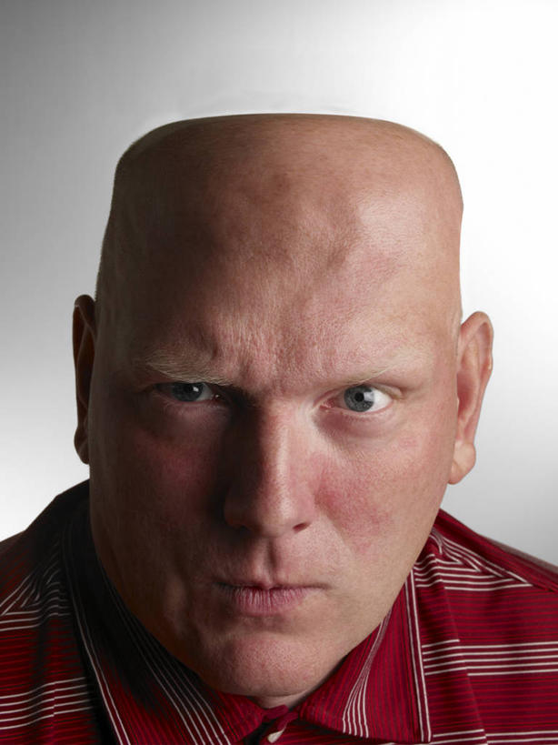 成年人,中年人,脸,头,眼睛,脸颊,秃头,一个人,竖图,正面,衬衫,仅一个男性,仅一个人,仅一个中年男性,灰色背景,肩膀,蓝色,摄影,肖像,畸形,男人,男性,中年男性,头部,光头,无发,脸部,脸蛋,面部,彩图,影棚拍摄