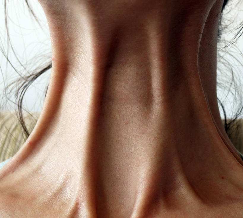 成年人,脖子,一个人,横图,室外,特写,白天,克罗地亚,仅一个女性,伸展,压力,人体,摄影,皮肤,苗条,巴尔干