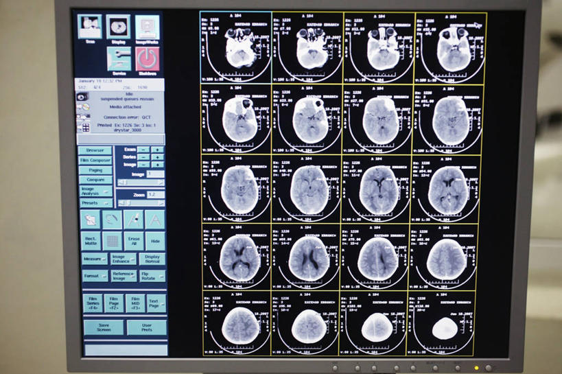 脑,无人,医院,横图,室内,特写,重复,显示器,技术,英格兰,生病,摄影,CAT扫描仪,囊性纤维化,彩图