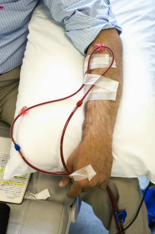 成年人,老年人,一个人,病人,竖图,特写,正面,英国,仅一个男性,仅一个人,仅一个中年男性,管子,首都,生病,摄影,部分,疾病,医疗器械,内分泌系统,四肢,男人,男性,中年男性,手臂,绷带,彩图